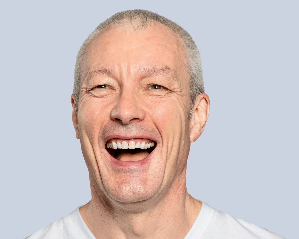 Smiling senior man with secure snap-on dentures supported by dental implants